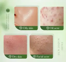  سرم ضد جوش و کنترل چربی چای سبز و سالیسیلیک اسید سادوئر