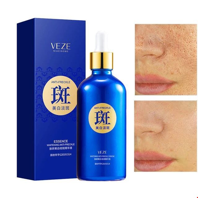 سرم صورت ضد لک و روشن کننده وزه   Veze Serum